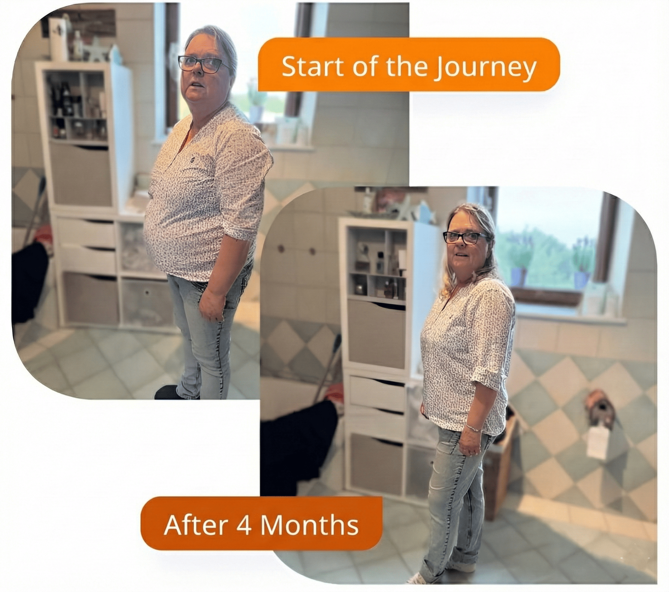 Before and After Mounjaro